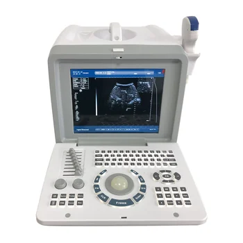 Medicinos Ultragarso Instrumentą, Nešiojamų B Echoskopija B/W Režimas Ultragarsinio skenavimo Aparatas