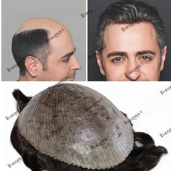 Natūralių Žmogaus Plaukų, Odos Ir Poli Mens Toupee Iš Anksto Supjaustytos Gamtos Valsčiaus Lengva Įdiegti Plaukų Pakeitimo Vieneto Protezavimas Kapiliarų Sistemos